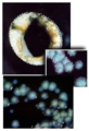 Legionella colonies on agar.png